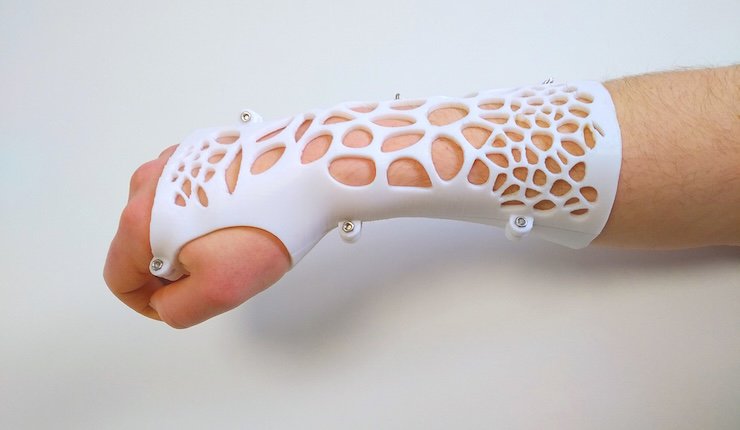 arm-splint-3d-print-3d-model-obj-stl-3dm-ige-stp-amf (1).jpg