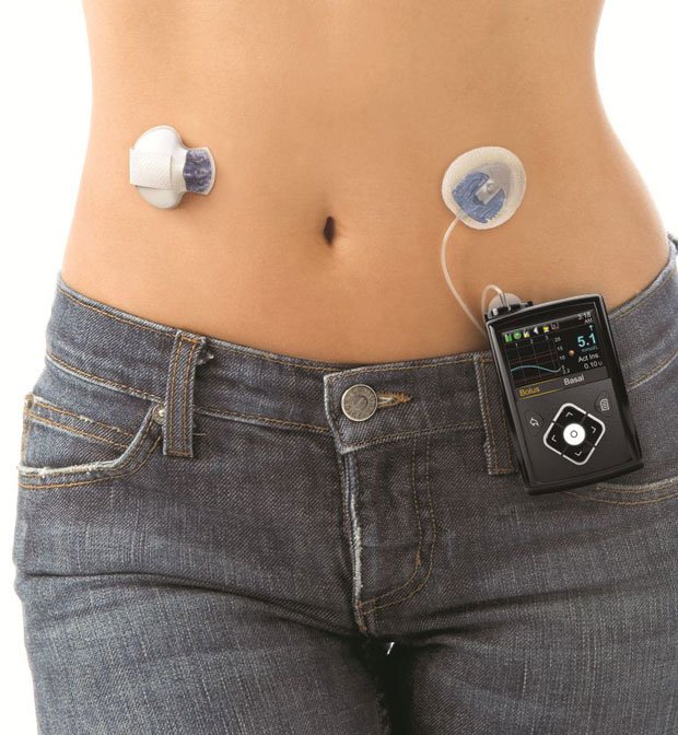 medtronic diabetes sensor