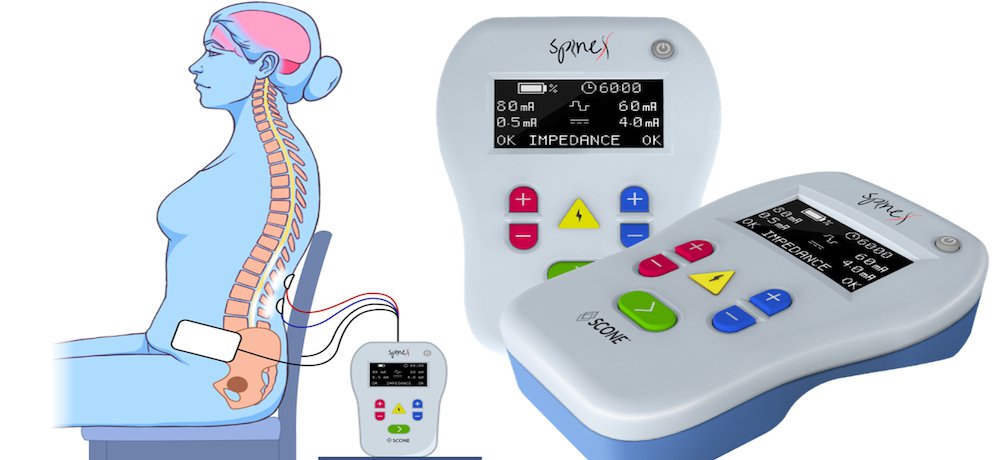 SunTech Vet25 Veterinary Blood Pressure Monitor - SunTech Medical